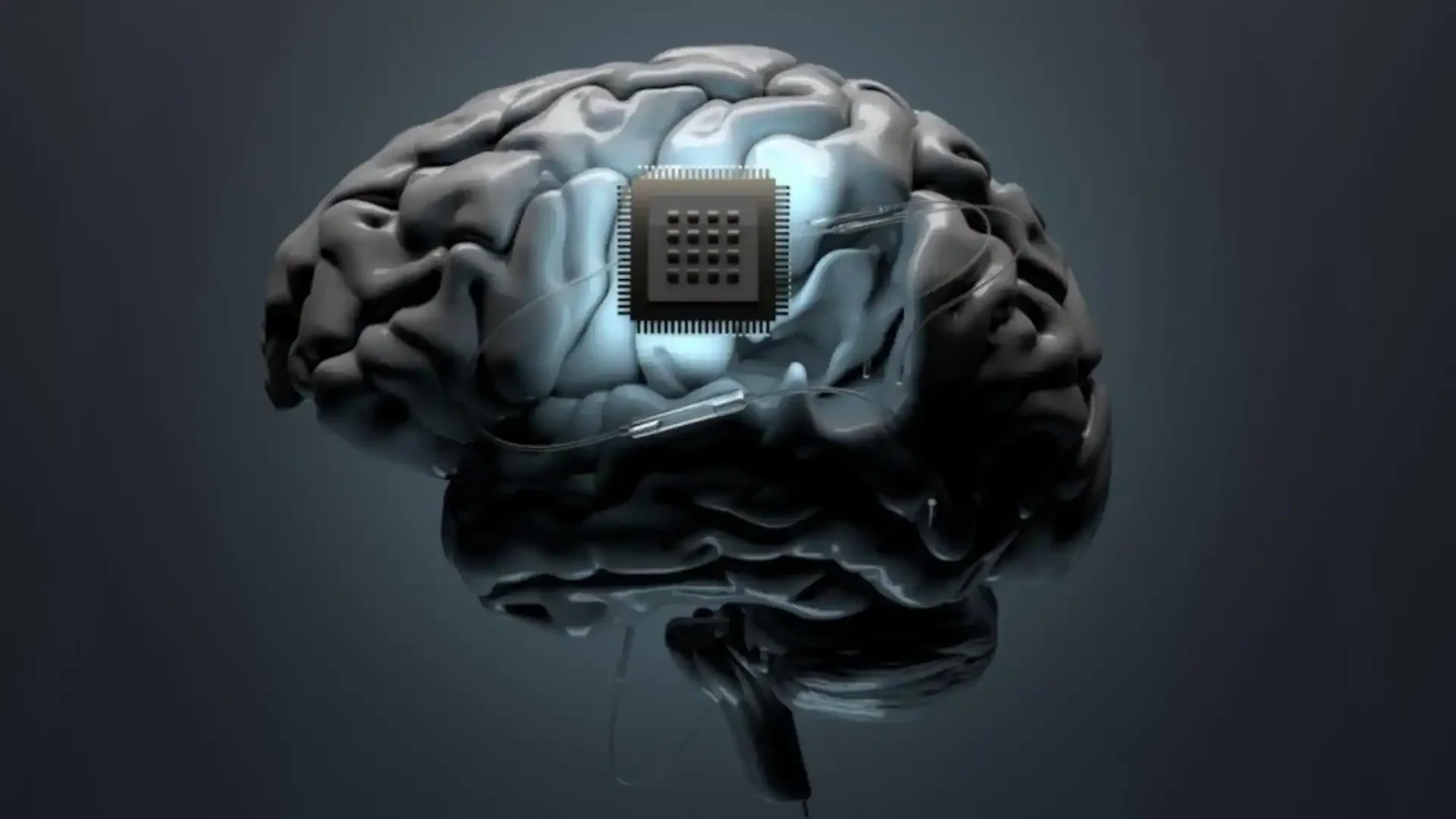 China Enters the Brain-Computer Race